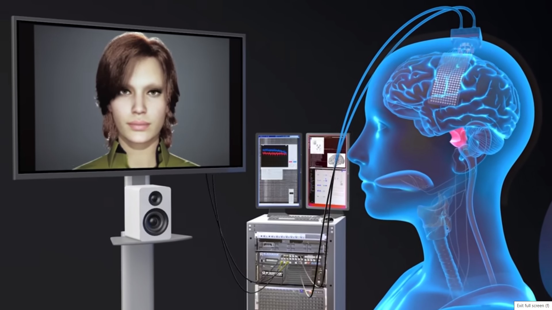 Researchers Harnessed Video Game Tech To Give Voice To A Woman Paralyzed By Stroke